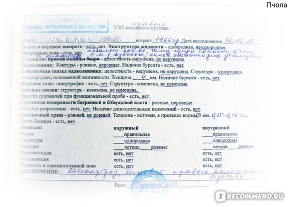 Артра цена от 928 руб, Артра купить в Москве, инструкция по применению, аналоги, отзывы