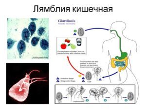 Эозинофилы при астме. Эозинофилия