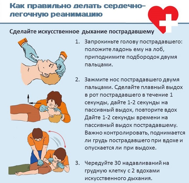 Сердечно-легочная реанимация
