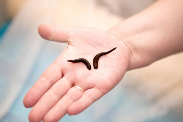 Как остановить кровь после пиявок и что означают сгустки крови после пиявок