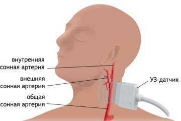 УЗДГ БЦА: что это такое, показания, проведение, расшифровка результатов
