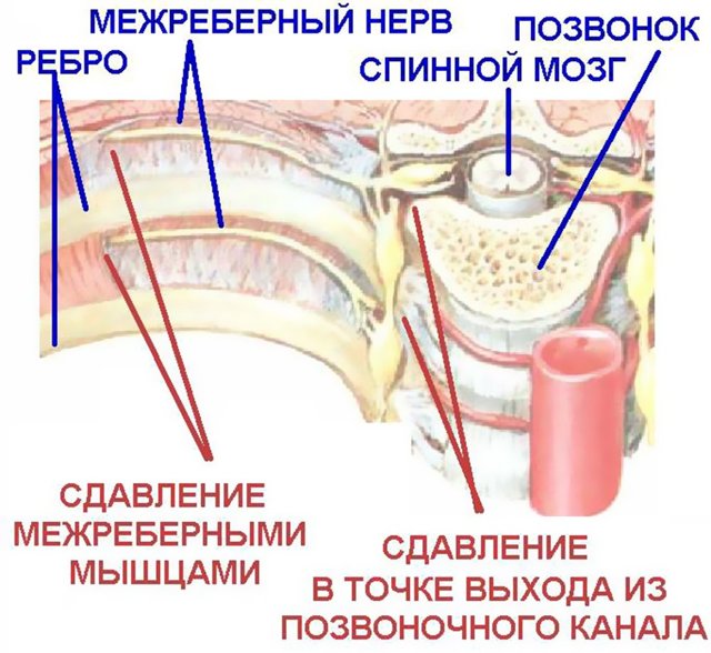 Может ли сердце болеть постоянно - Боль в Сердце