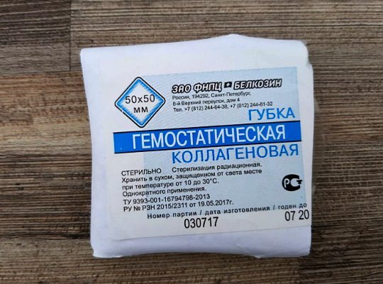 Кровь из носа: причины у взрослого и методы лечения дома