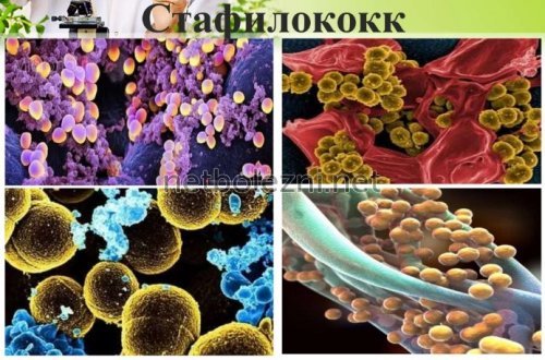 Золотистый стафилококк у детей и взрослых, симптомы и лечение