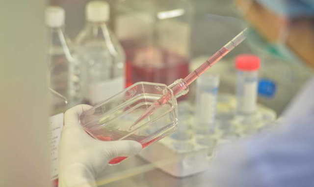 Соотношение аст и алт норма — Лечим печень