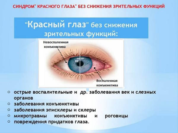 Как улучшить кровоснабжение глаза. Глаз, кровообращение в сосудах