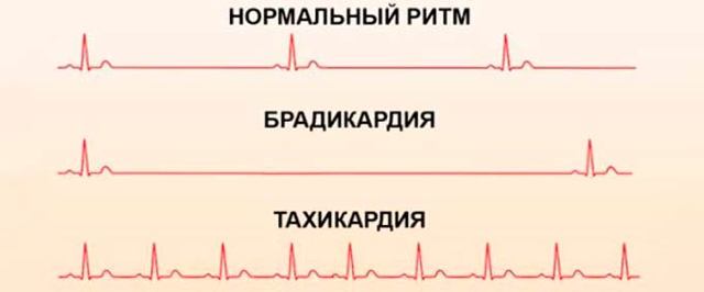 Пульс ночью норма у мужчин - Все про гипертонию