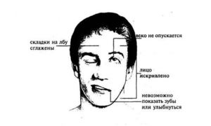 Левосторонний гемипарез после инсульта симптомы - Последствия инсульта