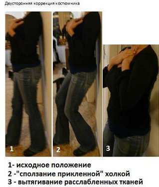 Как убрать горб на спине: эффективные способы лечения