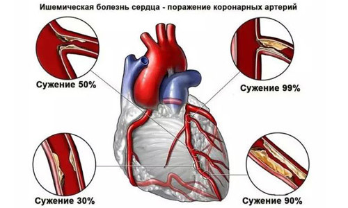 Красное вино повышает или понижает давление