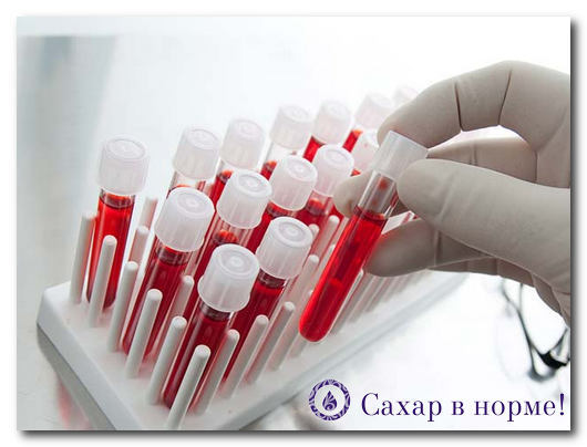 Уровень глюкозы в крови: норма
