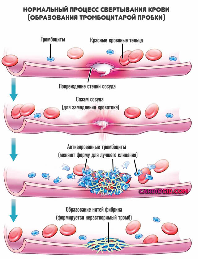 Анализ крови на МНО: показания, норма, расшифровка