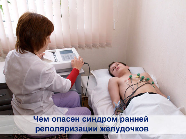 Синдром ранней реполяризации желудочков (СРРЖ)