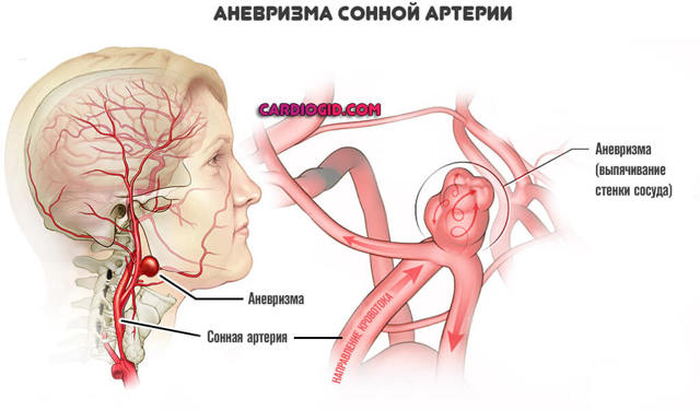 Антикоагулянты – механизм действия, список препаратов