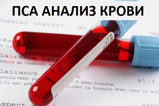 Анализ крови на ПСА и расшифровка результатов