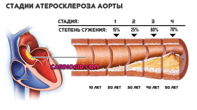 Почему давление высокое вечером. Почему повышается давление вечером. Народные методы лечения