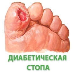 Солкосерил мазь и гель - инструкция по применению, аналоги