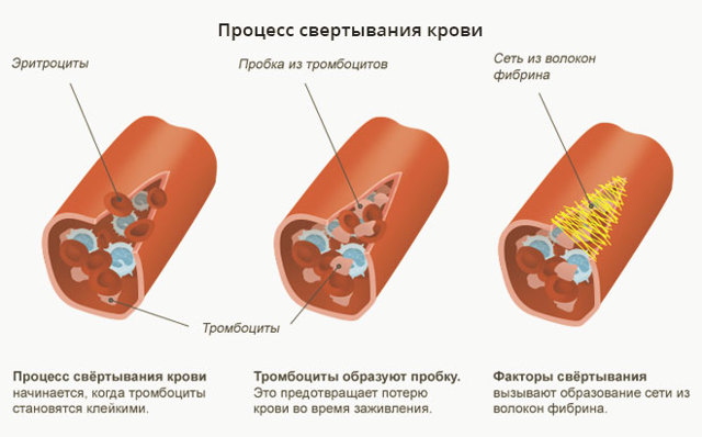 Коагулограмма - что это за анализ, как подготовиться, где сдавать, расшифровка результатов у взрослых, детей, беременных