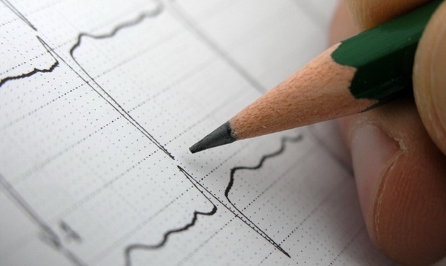 Инфаркт миокарда: что это такое, симптомы, лечение, последствия