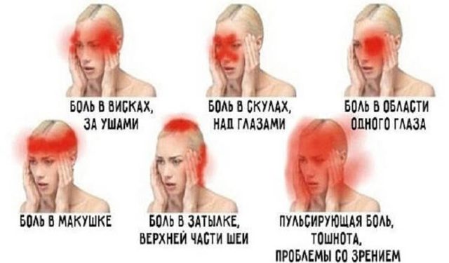 Всё о головной боли: характер, виды, первичная, вторичная