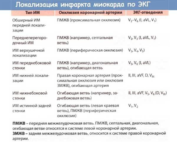 Инфаркт миокарда на ЭКГ: признаки, расшифровка