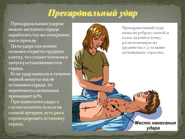 Синдром Морганьи-Адамса-Стокса - презентация онлайн