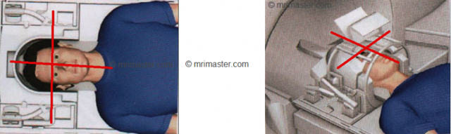 Ангиография (МРА) головного мозга. Личный опыт