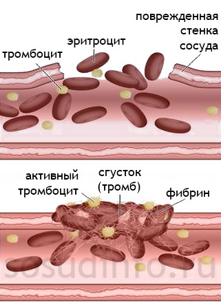 Коагулограмма - что это за анализ, как подготовиться, где сдавать, расшифровка результатов у взрослых, детей, беременных