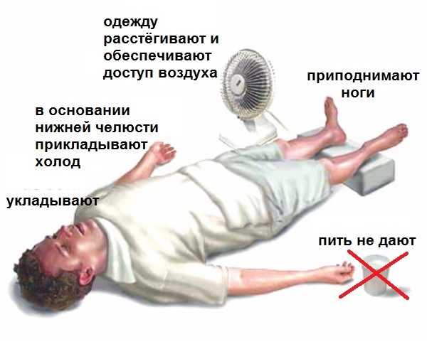 Геморрагический инсульт алгоритм неотложной помощи - Инсульт