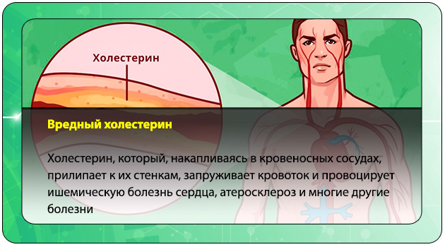 Как почистить сосуды ног от бляшек: обзор препаратов и народных средств