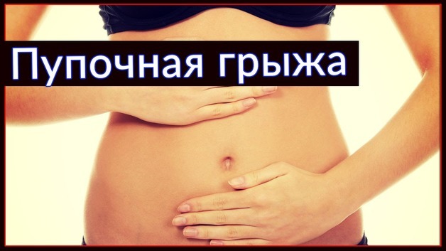 Пупочная грыжа у женщин, у взрослых – симптомы, лечение без операции, операция