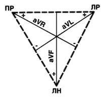 Стандартные отведения от конечностей - 1,2,3