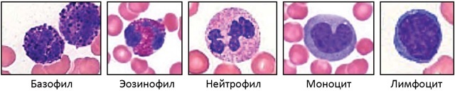 Моноциты повышены: допустимые нормы и причины превышений