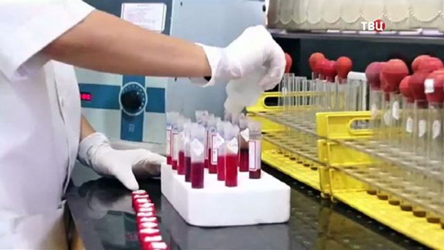 Анализ крови РФМК - что это, расшифровка коагулограммы РФМК