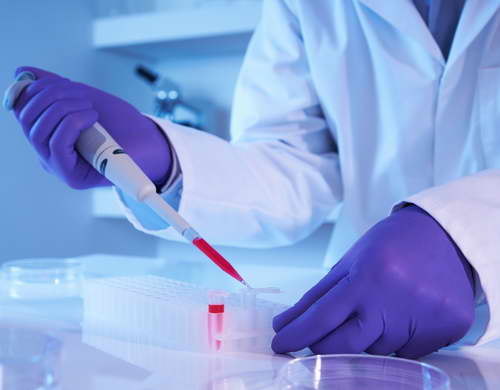 Расшифровка биохимического анализа крови – подготовка, проведение и анализ результатов