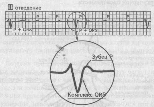 Атриовентрикулярная проводимость Википедия