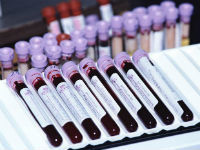 Анализ PH крови — как определить уровень КЩБ, причины повышения и понижения