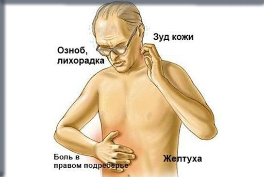 Что это значит - у взрослого повышен общий билирубин