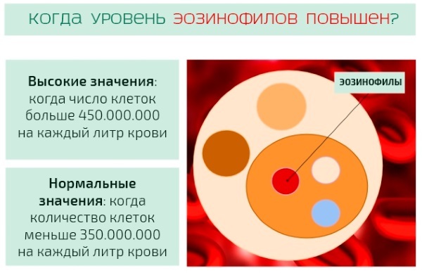 Эозинофилы повышены: патология или вариант нормы