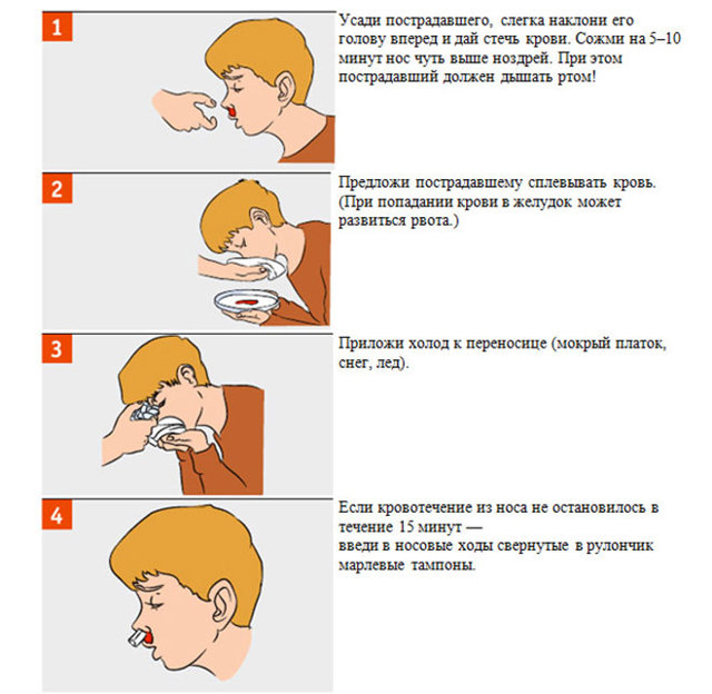 Как остановить кровотечение из носа в домашних условиях