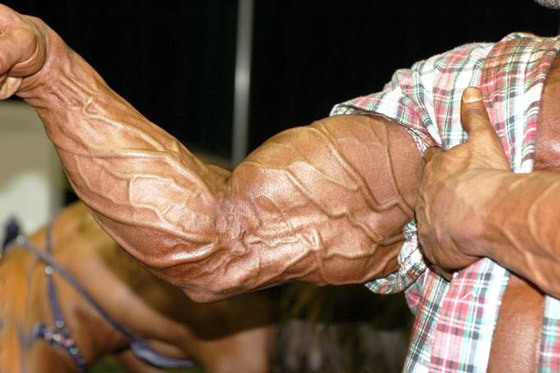 Выступают вены на руках у женщин и мужчин: причины, лечение сильно выпирающих вен