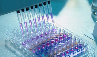 ИФА анализ крови: что такое, почему положительный, расшифровка теста