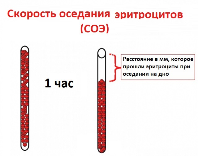 Что делать, если густая кровь при беременности? - Здоровая кровь