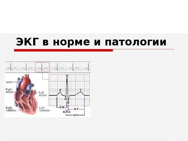Расшифровка ЭКГ в норме и при патологии. Уроки по ЭКГ с видео