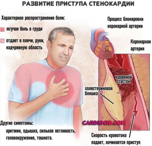 Ноющая боль в области сердца: причины и лечение