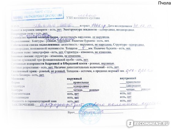 Артра цена от 928 руб, Артра купить в Москве, инструкция по применению, аналоги, отзывы