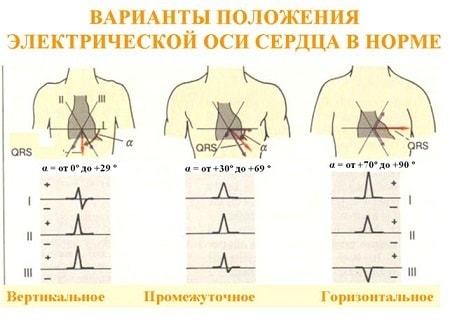 Вертикальное, горизонтальное положение ЭОС : что это такое?