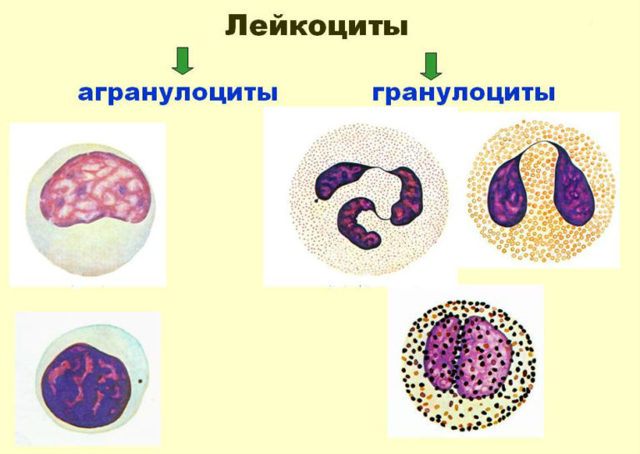 У взрослого повышены лимфоциты - о чем это говорит