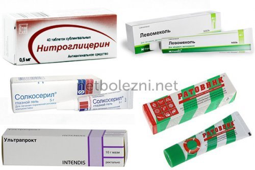 Анальные трещины при геморрое: лечение, свечи, мазь