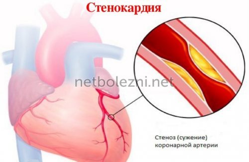 Антикоагулянты – механизм действия, список препаратов